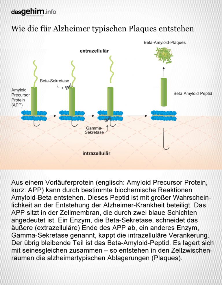 Entstehung von Alzheimer-Plaques